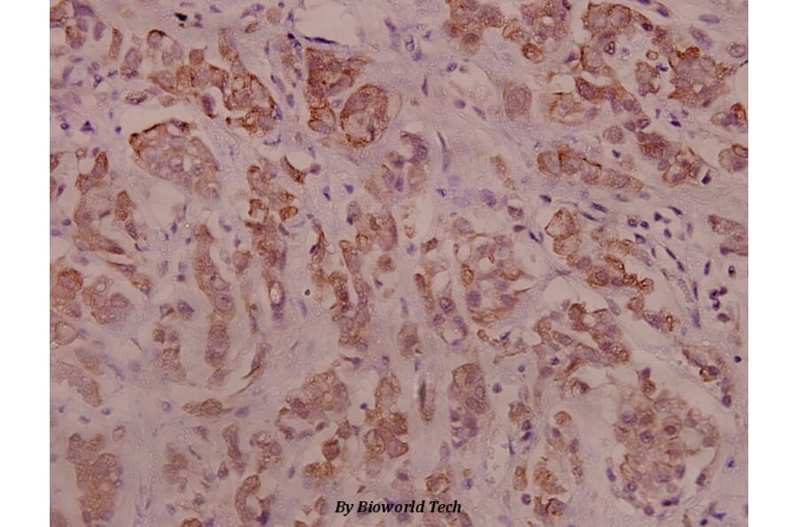 Anti-IRS-1 (phospho-S794) Antibody from Bioworld Technology (BS4321) - Antibodies.com