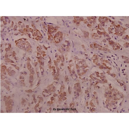 Anti-IRS-1 (phospho-S794) Antibody from Bioworld Technology (BS4321) - Antibodies.com