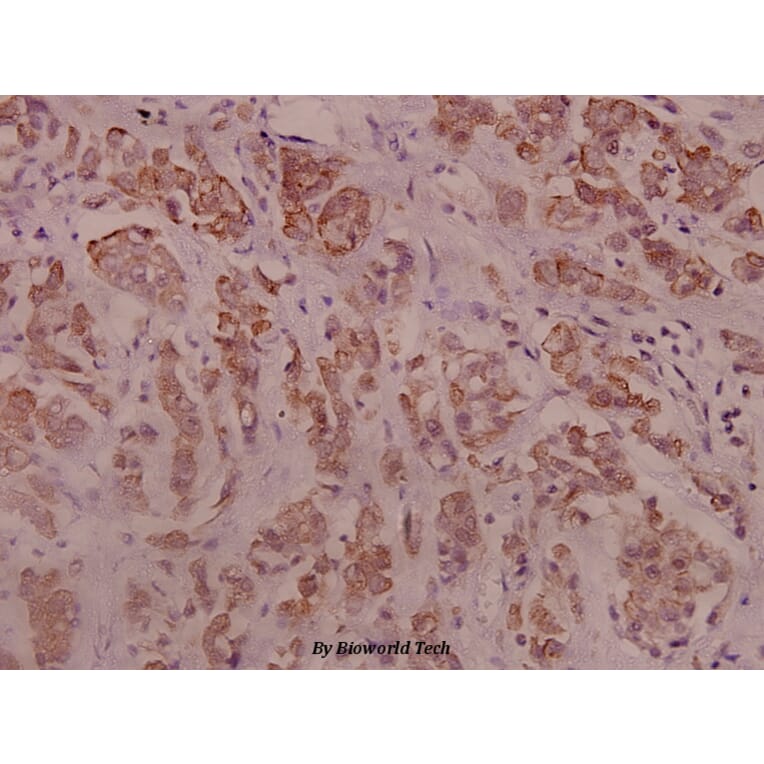 Anti-IRS-1 (phospho-S794) Antibody from Bioworld Technology (BS4321) - Antibodies.com