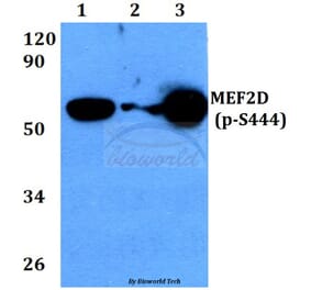 Anti-MEF2D (phospho-S444) Antibody from Bioworld Technology (BS4326) - Antibodies.com