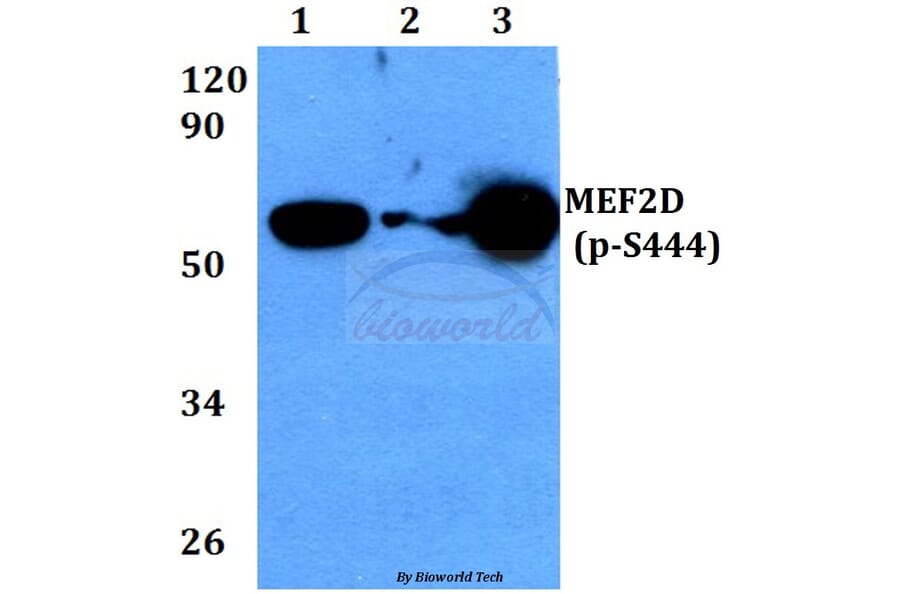 Anti-MEF2D (phospho-S444) Antibody from Bioworld Technology (BS4326) - Antibodies.com