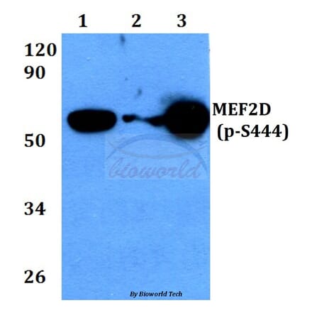 Anti-MEF2D (phospho-S444) Antibody from Bioworld Technology (BS4326) - Antibodies.com