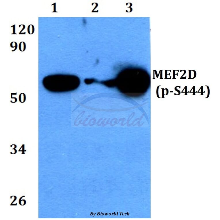 Anti-MEF2D (phospho-S444) Antibody from Bioworld Technology (BS4326) - Antibodies.com