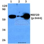 Anti-MEF2D (phospho-S444) Antibody from Bioworld Technology (BS4326) - Antibodies.com