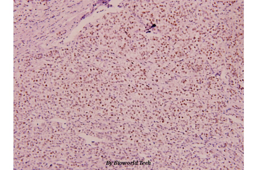 Anti-MEF2D (phospho-S444) Antibody from Bioworld Technology (BS4326) - Antibodies.com
