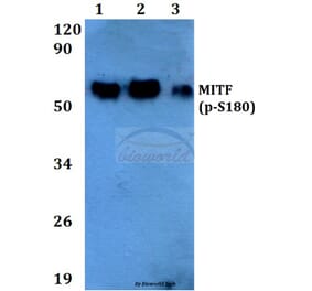Anti-MITF (phospho-S180) Antibody from Bioworld Technology (BS4328) - Antibodies.com