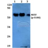 Anti-MITF (phospho-S180) Antibody from Bioworld Technology (BS4328) - Antibodies.com