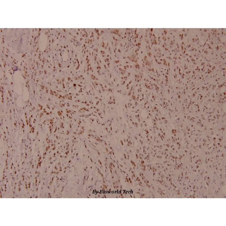 Anti-MITF (phospho-S180) Antibody from Bioworld Technology (BS4328) - Antibodies.com