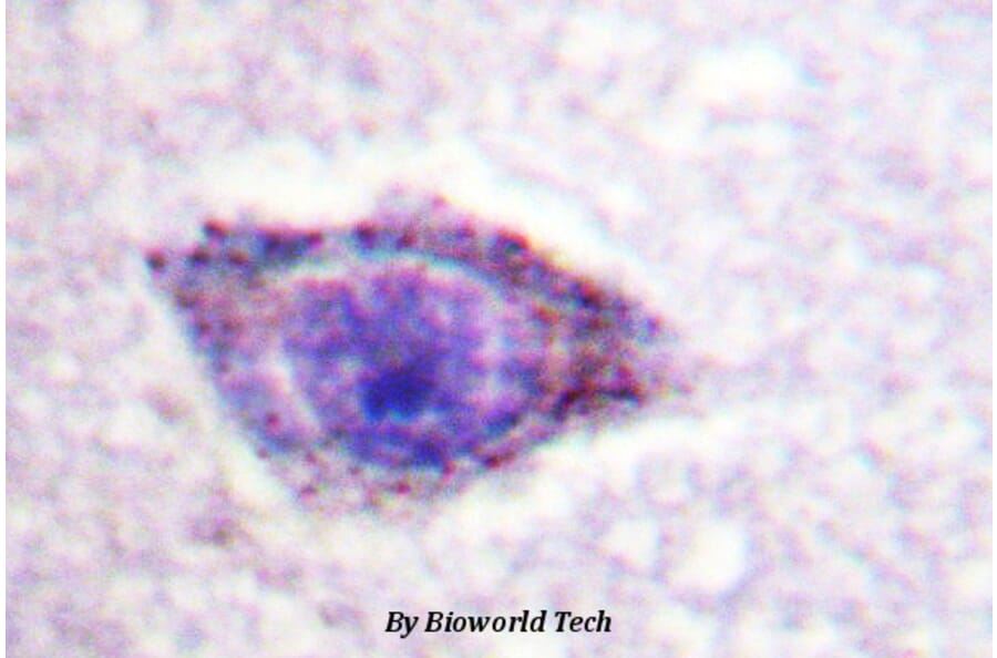 Anti-p70 S6K (phospho-T229) Antibody from Bioworld Technology (BS4339) - Antibodies.com