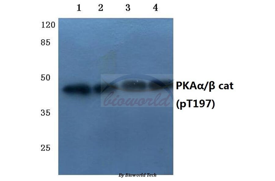 Anti-PKAα/β cat (phospho-T197) Antibody from Bioworld Technology (BS4345) - Antibodies.com