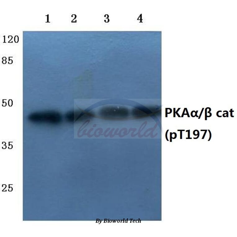Anti-PKAα/β cat (phospho-T197) Antibody from Bioworld Technology (BS4345) - Antibodies.com