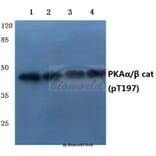 Anti-PKAα/β cat (phospho-T197) Antibody from Bioworld Technology (BS4345) - Antibodies.com
