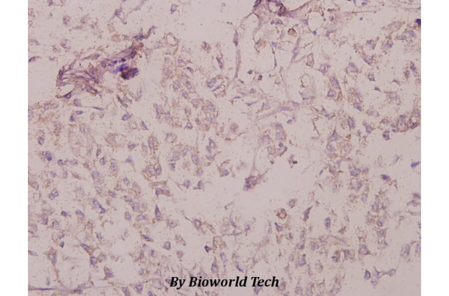 Anti-PKAα/β cat (phospho-T197) Antibody from Bioworld Technology (BS4345) - Antibodies.com