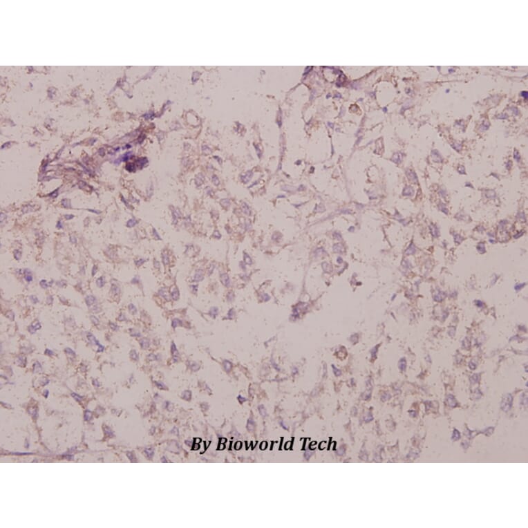 Anti-PKAα/β cat (phospho-T197) Antibody from Bioworld Technology (BS4345) - Antibodies.com
