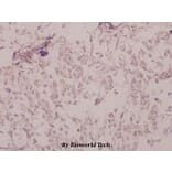 Anti-PKAα/β cat (phospho-T197) Antibody from Bioworld Technology (BS4345) - Antibodies.com