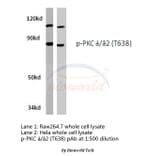 Anti-PKC α (phospho-T638) Antibody from Bioworld Technology (BS4346) - Antibodies.com