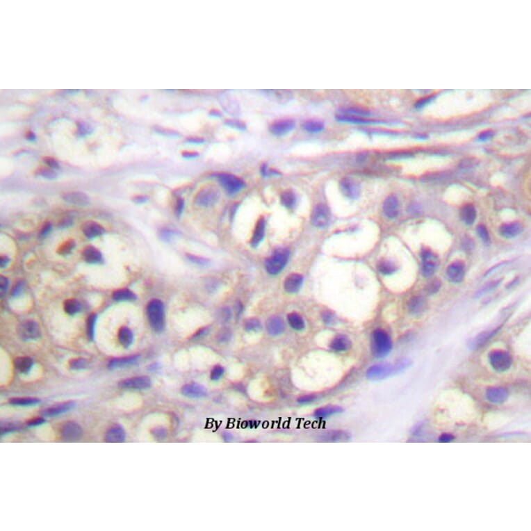 Anti-PKC α (phospho-T638) Antibody from Bioworld Technology (BS4346) - Antibodies.com