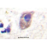 Anti-PKC ζ (phospho-T560) Antibody from Bioworld Technology (BS4347) - Antibodies.com