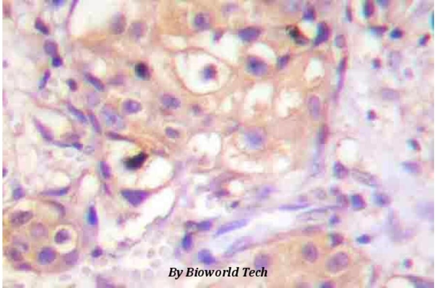 Anti-PKC-pan (αT497) Antibody from Bioworld Technology (BS4348) - Antibodies.com