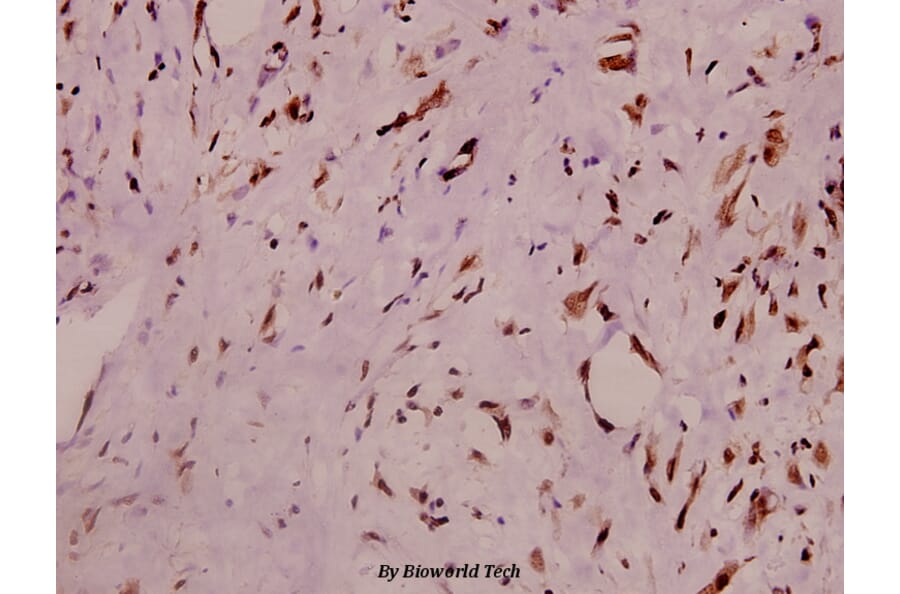 Anti-RyR2 (phospho-S2808) Antibody from Bioworld Technology (BS4358) - Antibodies.com