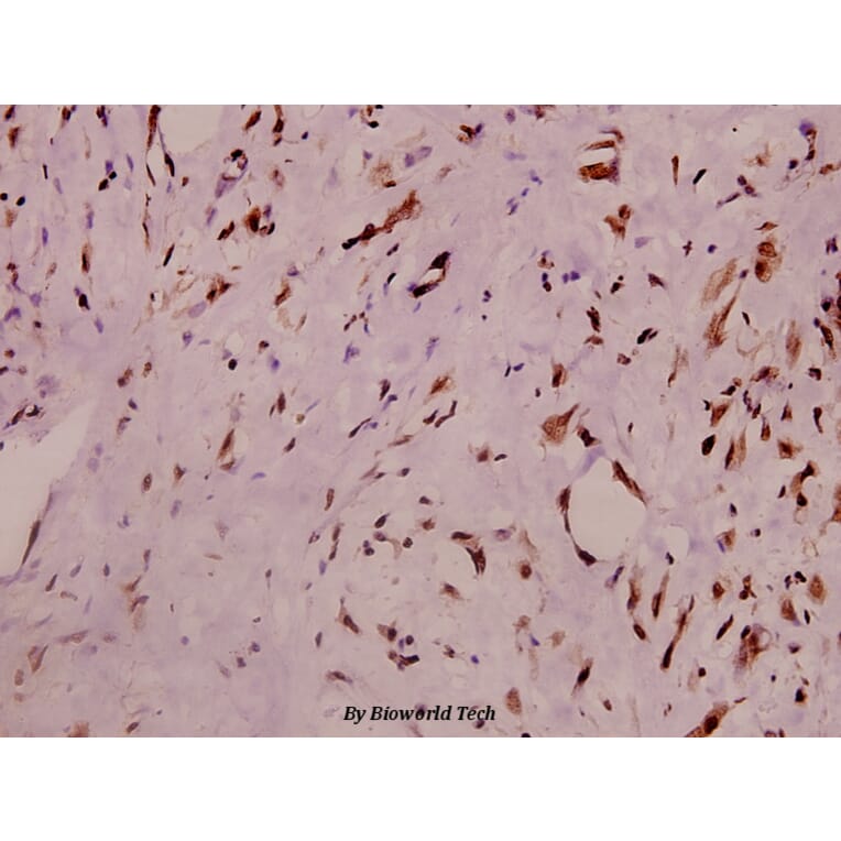 Anti-RyR2 (phospho-S2808) Antibody from Bioworld Technology (BS4358) - Antibodies.com