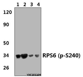 Anti-RPS6 (phospho-S240) Antibody from Bioworld Technology (BS4359) - Antibodies.com