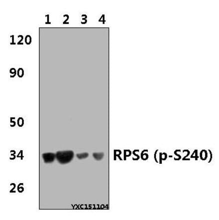 Anti-RPS6 (phospho-S240) Antibody from Bioworld Technology (BS4359) - Antibodies.com