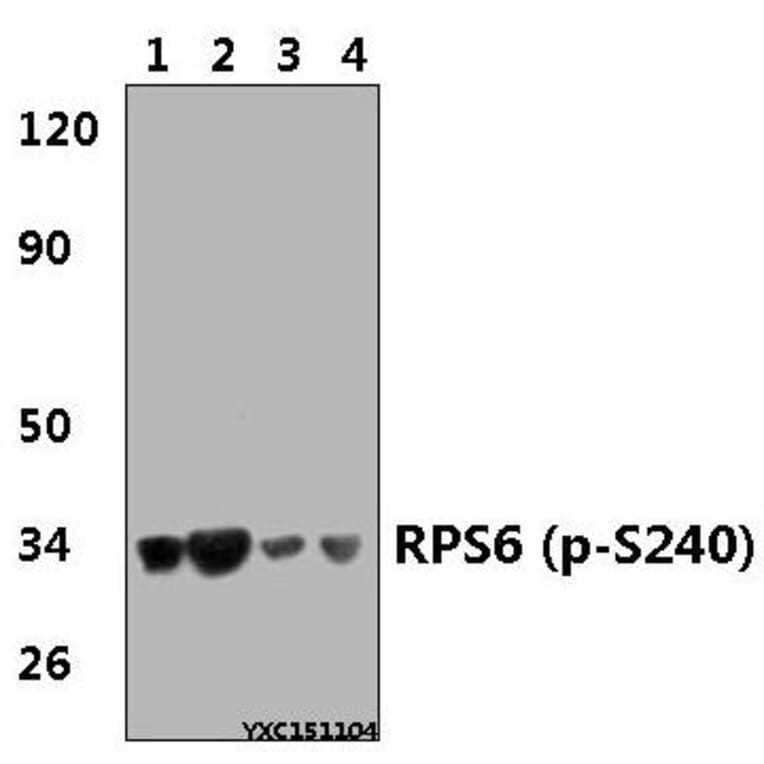 Anti-RPS6 (phospho-S240) Antibody from Bioworld Technology (BS4359) - Antibodies.com