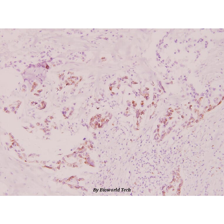 Anti-RPS6 (phospho-S240) Antibody from Bioworld Technology (BS4359) - Antibodies.com
