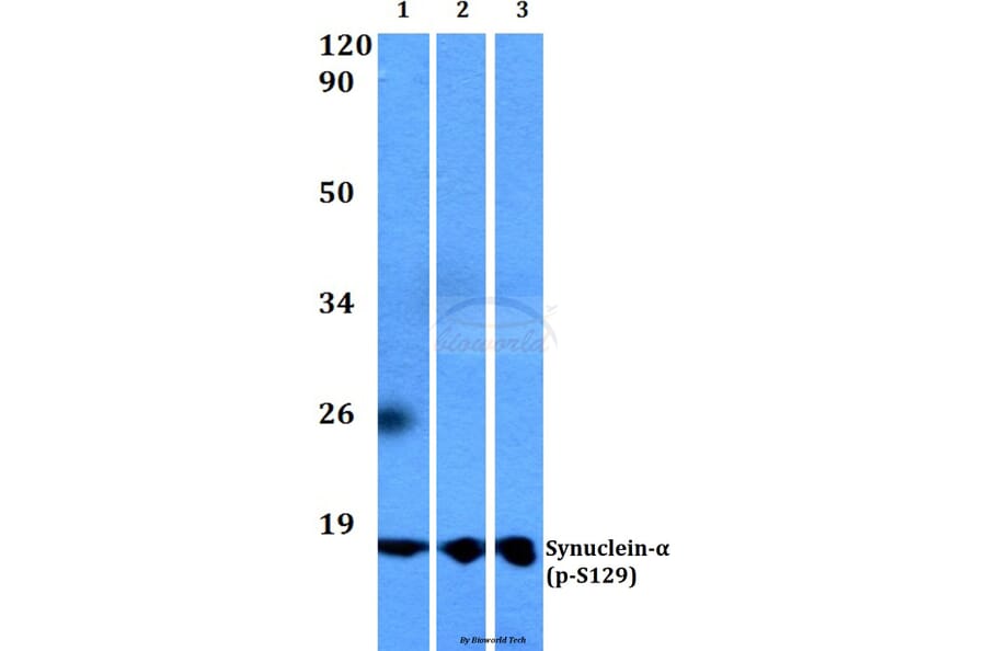 Anti-Synuclein-α (phospho-S129) Antibody from Bioworld Technology (BS4361) - Antibodies.com
