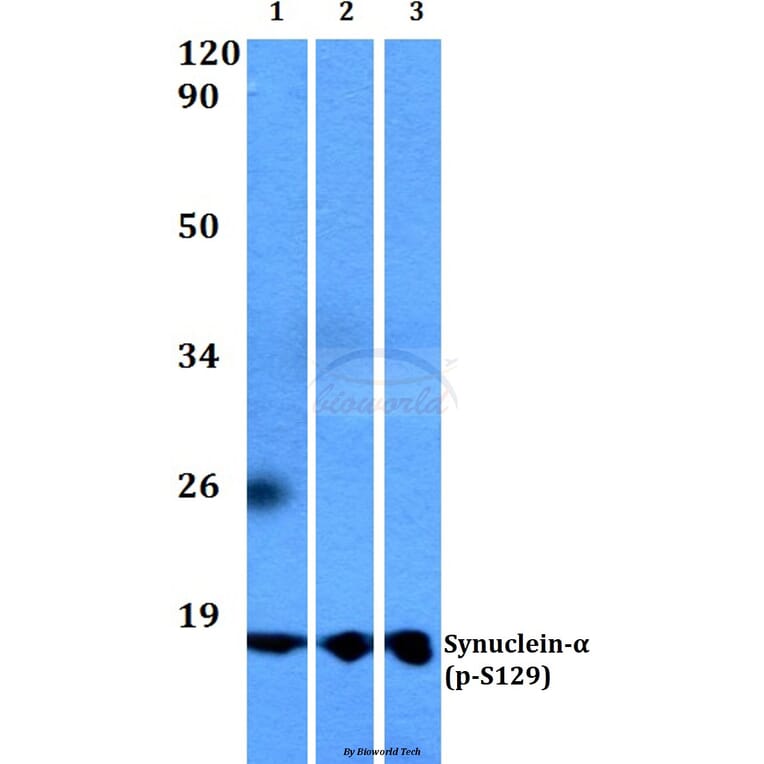 Anti-Synuclein-α (phospho-S129) Antibody from Bioworld Technology (BS4361) - Antibodies.com
