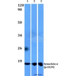 Anti-Synuclein-α (phospho-S129) Antibody from Bioworld Technology (BS4361) - Antibodies.com