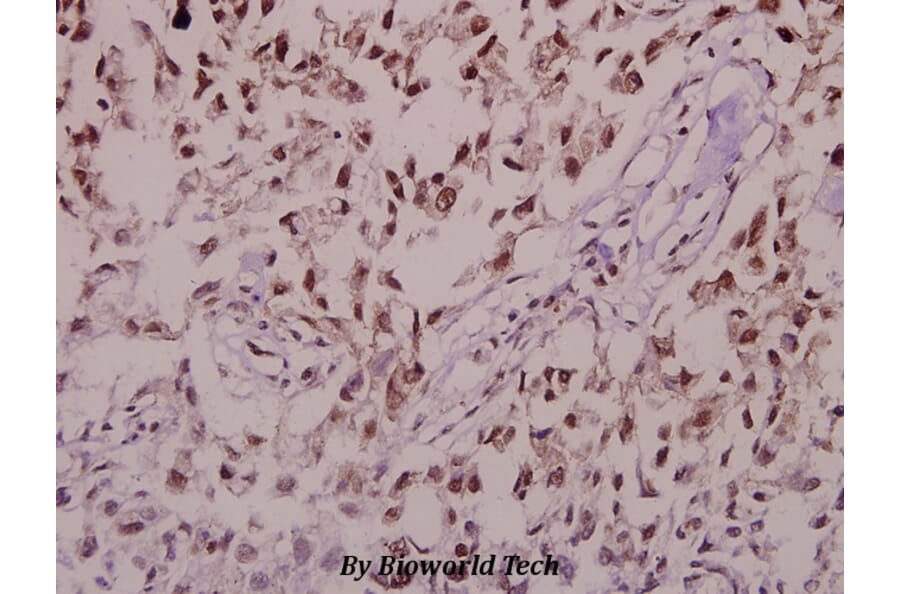 Anti-Synuclein-α (phospho-S129) Antibody from Bioworld Technology (BS4361) - Antibodies.com