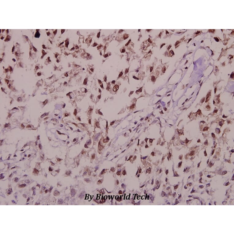 Anti-Synuclein-α (phospho-S129) Antibody from Bioworld Technology (BS4361) - Antibodies.com