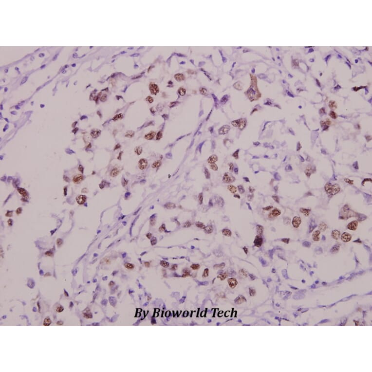 Anti-Sp1 (phospho-T453) Antibody from Bioworld Technology (BS4363) - Antibodies.com