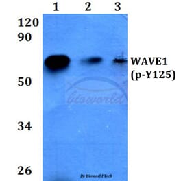 Anti-WAVE1 (phospho-Y125) Antibody from Bioworld Technology (BS4370) - Antibodies.com