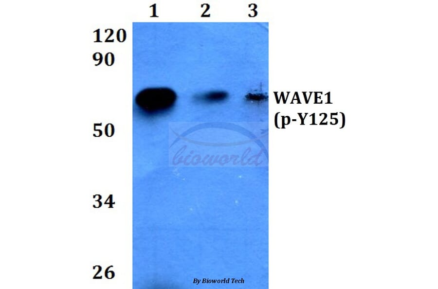 Anti-WAVE1 (phospho-Y125) Antibody from Bioworld Technology (BS4370) - Antibodies.com