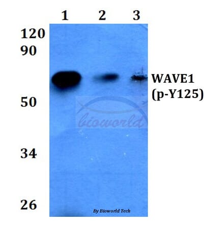 Anti-WAVE1 (phospho-Y125) Antibody from Bioworld Technology (BS4370) - Antibodies.com