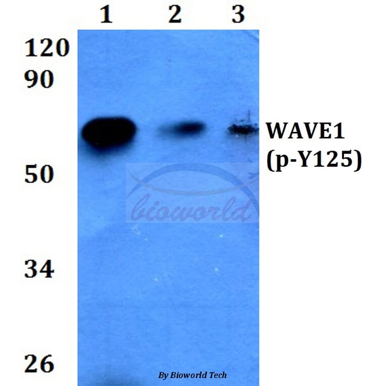 Anti-WAVE1 (phospho-Y125) Antibody from Bioworld Technology (BS4370) - Antibodies.com