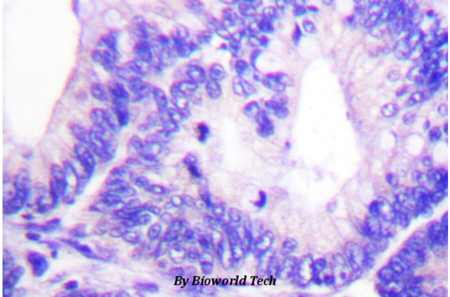 Anti-WAVE1 (phospho-Y125) Antibody from Bioworld Technology (BS4370) - Antibodies.com