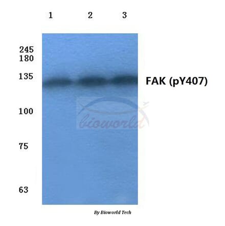 Anti-FAK (phospho-Y407) Antibody from Bioworld Technology (BS4406) - Antibodies.com