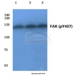 Anti-FAK (phospho-Y407) Antibody from Bioworld Technology (BS4406) - Antibodies.com