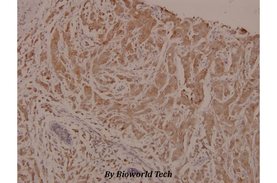 Anti-PKC α (phospho-T505) Antibody from Bioworld Technology (BS4441) - Antibodies.com