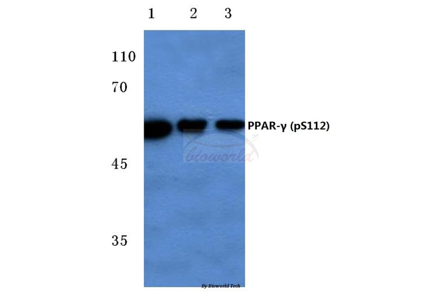 Anti-PPARγ (phospho-S112) Antibody from Bioworld Technology (BS4444) - Antibodies.com