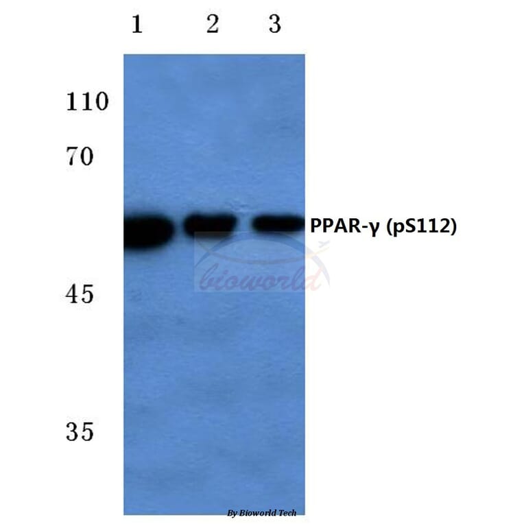 Anti-PPARγ (phospho-S112) Antibody from Bioworld Technology (BS4444) - Antibodies.com