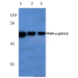 Anti-PPARγ (phospho-S112) Antibody from Bioworld Technology (BS4444) - Antibodies.com
