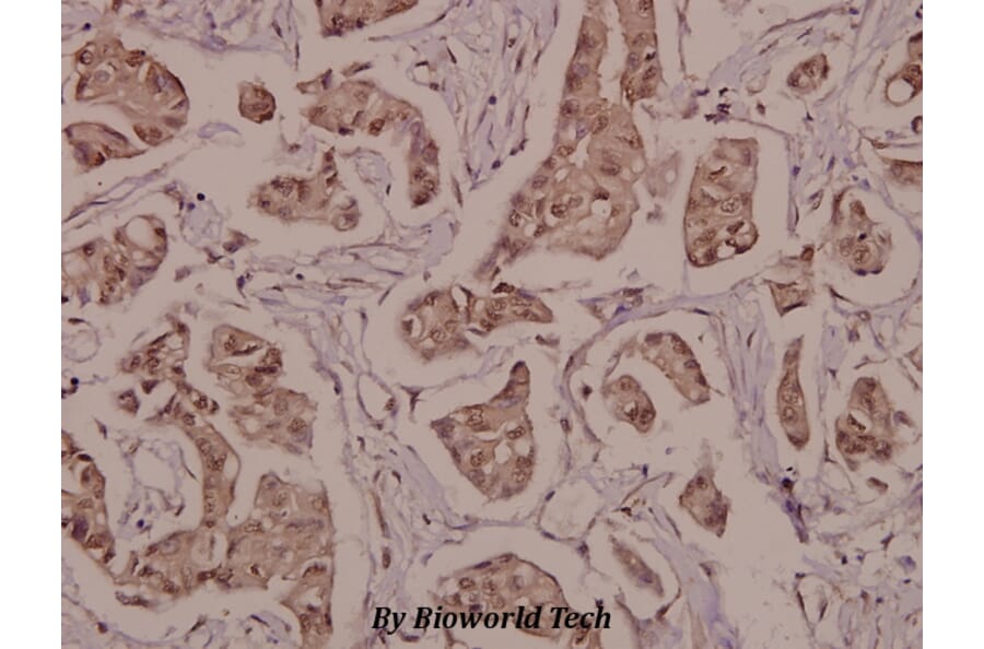 Anti-PPARγ (phospho-S112) Antibody from Bioworld Technology (BS4444) - Antibodies.com