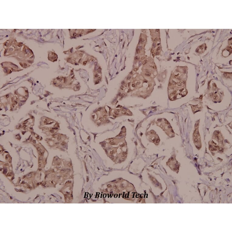 Anti-PPARγ (phospho-S112) Antibody from Bioworld Technology (BS4444) - Antibodies.com