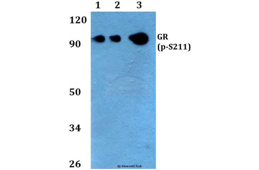 Anti-GR (phospho-S211) Antibody from Bioworld Technology (BS4459) - Antibodies.com