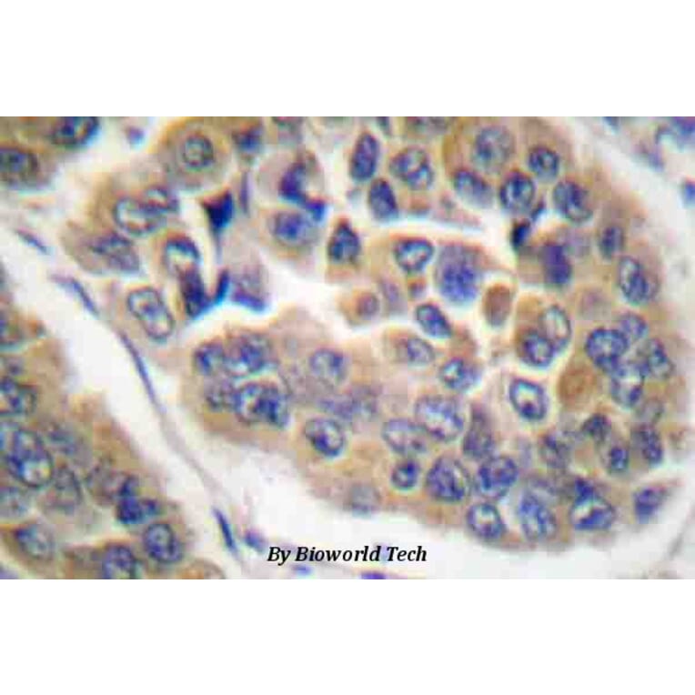 Anti-GR (phospho-S211) Antibody from Bioworld Technology (BS4459) - Antibodies.com